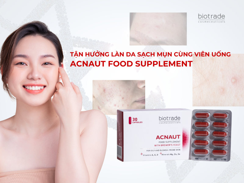 Tận Hưởng Làn Da Sạch Mụn Cùng Viên Uống Acnaut Food Supplement