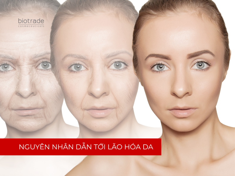 NGUYÊN NHÂN DẪN TỚI LÃO HÓA DA