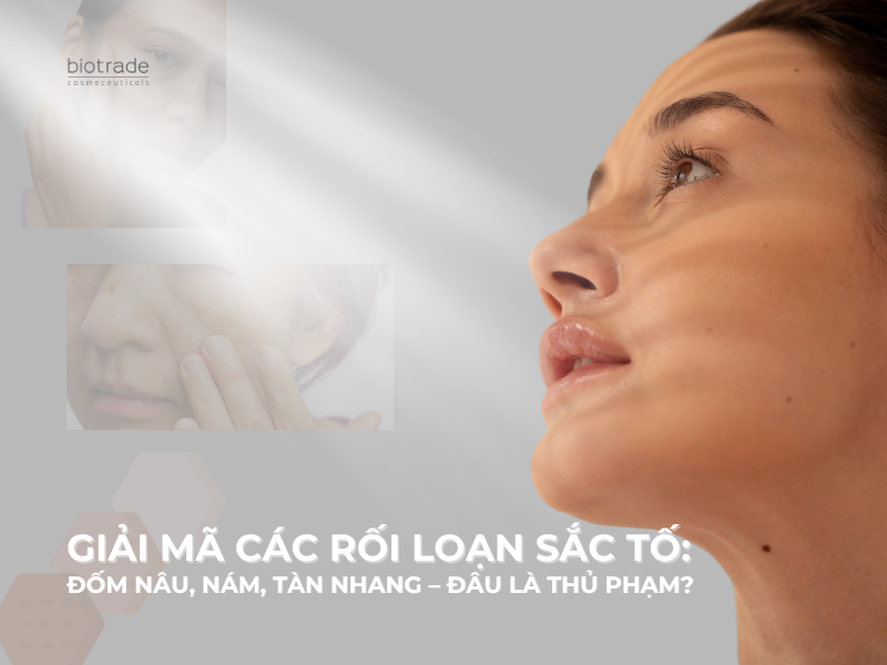 Giải mã các rối loạn sắc tố: Đốm nâu, nám, tàn nhang – đâu là thủ phạm?