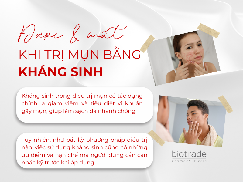 Được Và Mất Gì Khi Trị Mụn Bằng Kháng Sinh